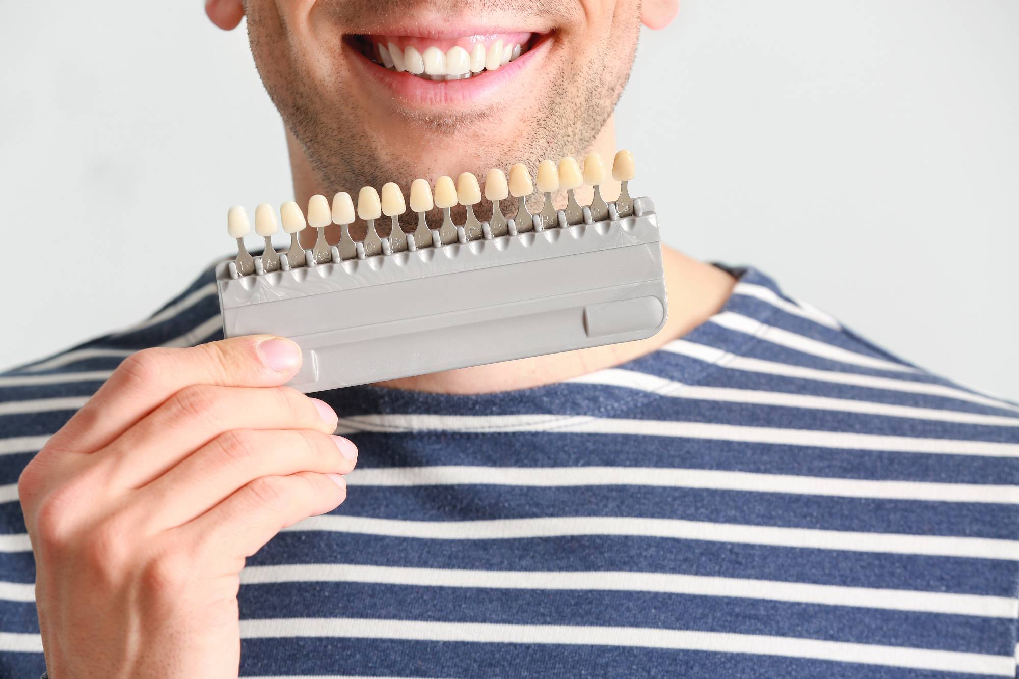 bleaching-farben-auswahl